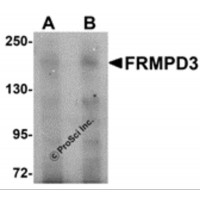 Western blot analysis of FRMPD3 in Jurkat cell lysate with FRMPD3 antibody at (A) 1 and (B) 2 μg/mL.
