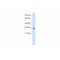 Antibody used in WB on Human Stomach at 1.25 ug/ml.