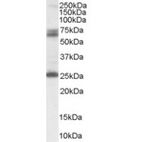 Western Blot (0.3μg/ml) staining of Human Hippocampus lysate (35μg protein in RIPA buffer). Primary incubation was 1 hour. Detected by chemiluminescence.