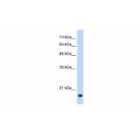 Antibody used in WB on Human HepG2 at 0.2-1 ug/ml.