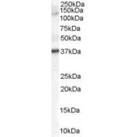 Western Blot (2μg/ml) staining of Human Skin lysate (35μg protein in RIPA buffer). Primary incubation was 1 hour. Detected by chemiluminescence.