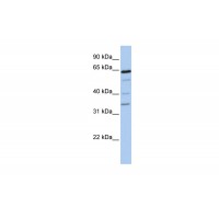 Antibody used in WB on Human 721_B at 0.2-1 ug/ml.