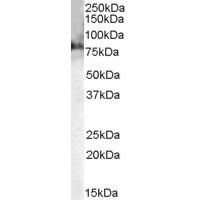 Western blot (0.2 μg/ml) staining of Mouse Brain lysate (35 μg protein in RIPA buffer). Primary incubation was 1 hour. Detected by chemiluminescence.