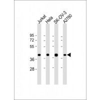 Western Blot at 1:2000 dilution Lane 1: Jurkat whole cell lysate Lane 2: Hela whole cell lysate Lane 3: SK-OV-3 whole cell lysate Lane 4: A2780 whole cell lysate Lysates/proteins at 20 ug per lane.