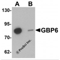 Western blot analysis of GBP6 in Hela cell lysate with GBP6 antibody at 0.5 μg/mL in (A) the absence and (B) the presence of blocking peptide.