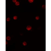 Immunofluorescence of GBP6 in HeLa cells with GBP6 antibody at 5 μg/mL.