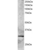Western Blot staining (2μg/ml) of Human Heart lysate (RIPA buffer, 35μg total protein per lane). Primary incubated for 1 hour. Detected by western blot using chemiluminescence.