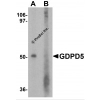 Western blot analysis of GDPD5 in mouse kidney tissue lysate with GDPD5 antibody at 1 μg/ml in (A) the absence and (B) the presence of blocking peptide.