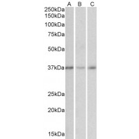 Western Blot (0.01μg/ml) staining of Human Cerebellum (A), Duodenum (B) and Heart (C) cell lysates (35μg protein in RIPA buffer). Primary incubation was 1 hour. Detected by chemiluminescence.