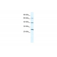 Antibody used in WB on Human HepG2 at 5.0 ug/ml.