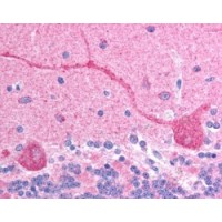 Immunohistochemistry (2.5μg/ml) staining of paraffin embedded human brain (cerImmunohistochemistry). Steamed antigen retrieval with citrate buffer pH 6, AP-staining.
