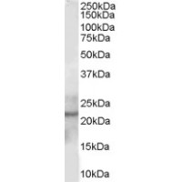 Western Blot staining (0.5μg/ml) of Human Liver lysate (RIPA buffer, 30μg total protein per lane). Primary incubated for 1 hour. Detected by western blot using chemiluminescence.
