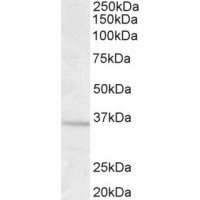 Western Blot (1.0μg/ml) staining of Human Brain (Frontal Cortex) lysate (35μg protein in RIPA buffer). Primary incubation was 1 hour. Detected by chemiluminescence.