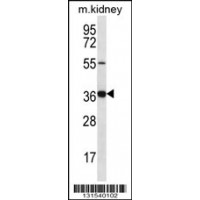 Western blot analysis in mouse kidney tissue lysates (35ug/lane).