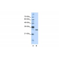 Antibody used in WB on Human HepG2 at 1.25 ug/ml.