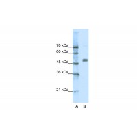 Antibody used in WB on Human Jurkat 0.0625 ug/ml.