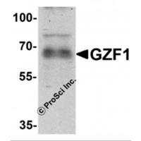 Western blot analysis of GZF1 in human heart tissue lysate with GZF1 antibody at 1 μg/mL.