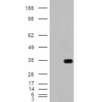 HEK293 overexpressing HADH with C-terminal tag (DYKDDDDK) and probed with anti-DYKDDDDK in the left panel and with antibody in the right panel (mock transfection in first and last lanes).