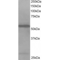 Western Blot staining (1μg/ml) of Jurkat lysate (RIPA buffer, 35μg total protein per lane). Primary incubated for 1 hour. Detected by western blot using chemiluminescence.