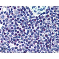 Immunohistochemistry (2.5μg/ml) staining of paraffin embedded Human Spleen. Steamed antigen retrieval with citrate buffer pH 6, AP-staining.