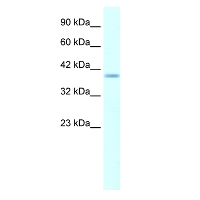 Antibody used in WB on Human Daudi at 5.0 ug/ml.
