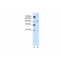 Antibody used in WB on Human Jurkat 0.2-1 ug/ml.