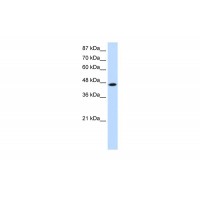 Antibody used in WB on Human Jurkat 0.2-1 ug/ml.