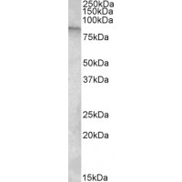 Western Blot (1μg/ml) staining of U937 lysate (35μg protein in RIPA buffer). Primary incubation was 1 hour. Detected by chemiluminescence.