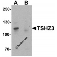 Western blot analysis of TSHZ3 in mouse brain tissue lysate with TSHZ3 antibody at 1 μg/mL in (A) the absence and (B) the presence of blocking peptide.