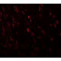 Immunofluorescence of TSHZ3 in mouse brain tissue with TSHZ3 antibody at 20 μg/mL.