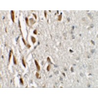 Immunohistochemistry of TSHZ3 in mouse brain tissue with TSHZ3 antibody at 2.5 μg/mL.