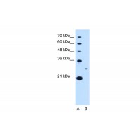 Antibody used in WB on Human HepG2 at 0.2-1 ug/ml.