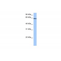 Antibody used in WB on Human Jurkat 0.2-1 ug/ml.