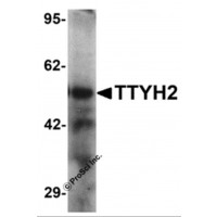 Western blot analysis of TTYH2 in human kidney tissue lysate with TTYH2 antibody at 1 μg/ml