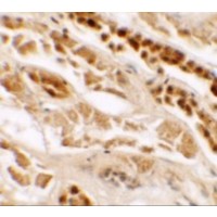 Immunohistochemistry of TTYH2 in human kidney tissue with TTYH2 antibody at 2.5 μg/mL.