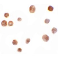 Immunocytochemistry of TYW2 in K562 cells with TYW2 antibody at 10 μg/mL.