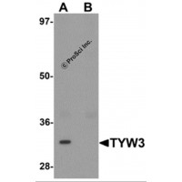 Western blot analysis of TYW3 in A549 cell lysate with TYW3 antibody at 1 μg/mL in (A) the absence and (B) the presence of blocking peptide.