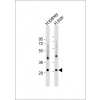 Western Blot at 1:1000 dilution Lane 1: human kidney lysate Lane 2: human liver lysate Lysates/proteins at 20 ug per lane.