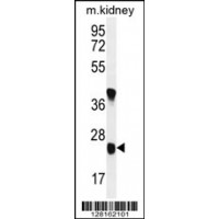 Western blot analysis in mouse kidney tissue lysates (35ug/lane).