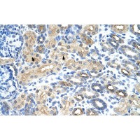 Antibody used in IHC on Human Kidney at 4.0-8.0 ug/ml.