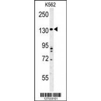 Western blot analysis in K562 cell line lysates (35ug/lane).