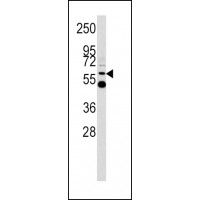 Western blot analysis of UDB17 antibody in Y79 cell line lysates (35ug/lane)