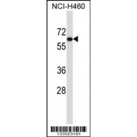 Western blot analysis in NCI-H460 cell line lysates (35ug/lane).