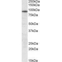 Western Blot (0.3μg/ml) staining of Human Skeletal Muscle lysate (35μg protein in RIPA buffer). Primary incubation was 1 hour. Detected by chemiluminescence.