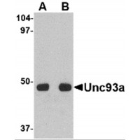 Western blot analysis of Unc93a in HeLa cell lysate with Unc93a antibody at (A) 0.5 and (B) 1 μg/mL.