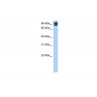 Antibody used in WB on Transfected 293T at 0.2-1 ug/ml.
