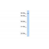 Antibody used in WB on Transfected 293T at 0.2-1 ug/ml.