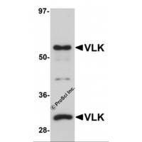 Western blot analysis of VLK in human lung tissue lysate with VLK antibody at 1 μg/mL.