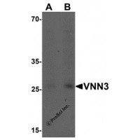 Western blot analysis of VNN3 in human brain tissue lysate with VNN3 antibody at (A) 0.5 and (B) 1 μg/mL.