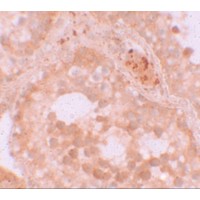 Immunohistochemistry of WDR92 in human testis tissue with WDR92 antibody at 10 μg/mL.